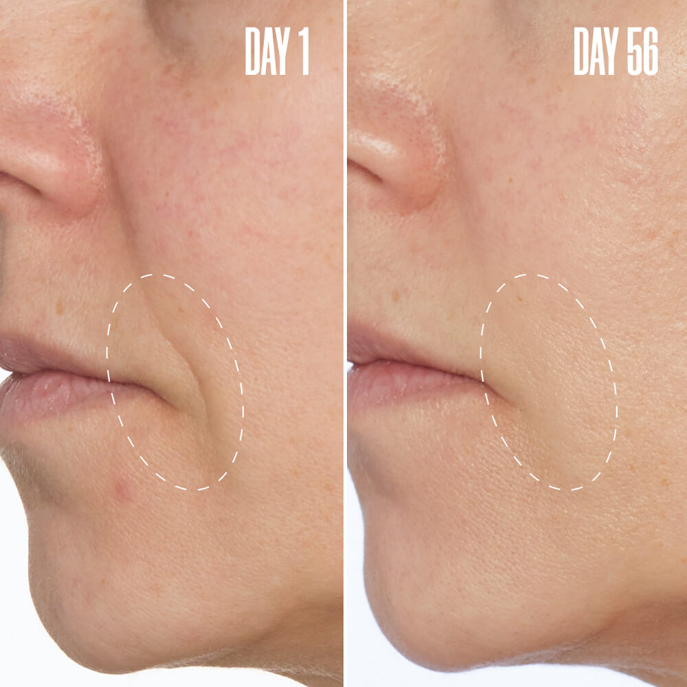 Clinically Proven Face Filling Cream product